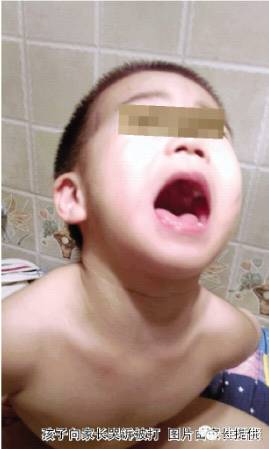 女子斥幼兒園虐打其子